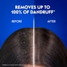 Head & Shoulders Menthol Refresh Anti-Dandruff Shampoo for Itchy Scalp 200 ml