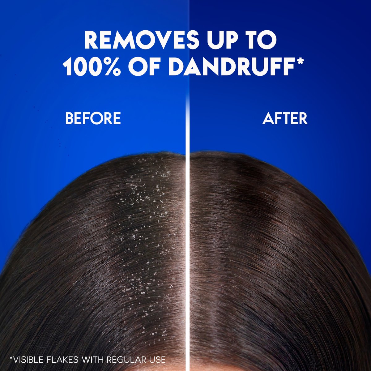 Head & Shoulders Menthol Refresh Anti-Dandruff Shampoo for Itchy Scalp 400 ml + 200 ml