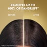 Head & Shoulders Supreme Anti-Dandruff Shampoo with Argan Oil for Dry Scalp Rejuvenation 200 ml